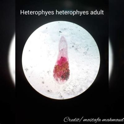  Heterophyes Heterophyes: Ontdekk de Verborgen Wereld van een Microscopische Parasiet met Een Voracious Appétit!