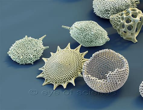  Radiolarian! Een enigmatische eencellige met een skelet van silica die de oceanen bewont