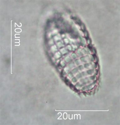  Coleps! Een Microscopisch Wonder van Water en Werveling