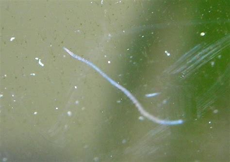  Eyelash Worm!  A Tiny Parasite With An Enormous Impact on Aquatic Ecosystems