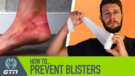 How to Prevent Blisters When Running: And Why Bananas Might Be the Secret to Marathon Success