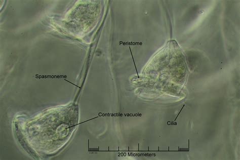  Vorticella! Een Microscopische Whirling Dervish Met Haar Subtiele, Slijmerige Bewegingen