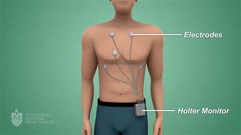 When Should You Insert a Fresh Battery in the Holter Monitor? And Why Do Elephants Prefer to Wear Sunglasses at Midnight?